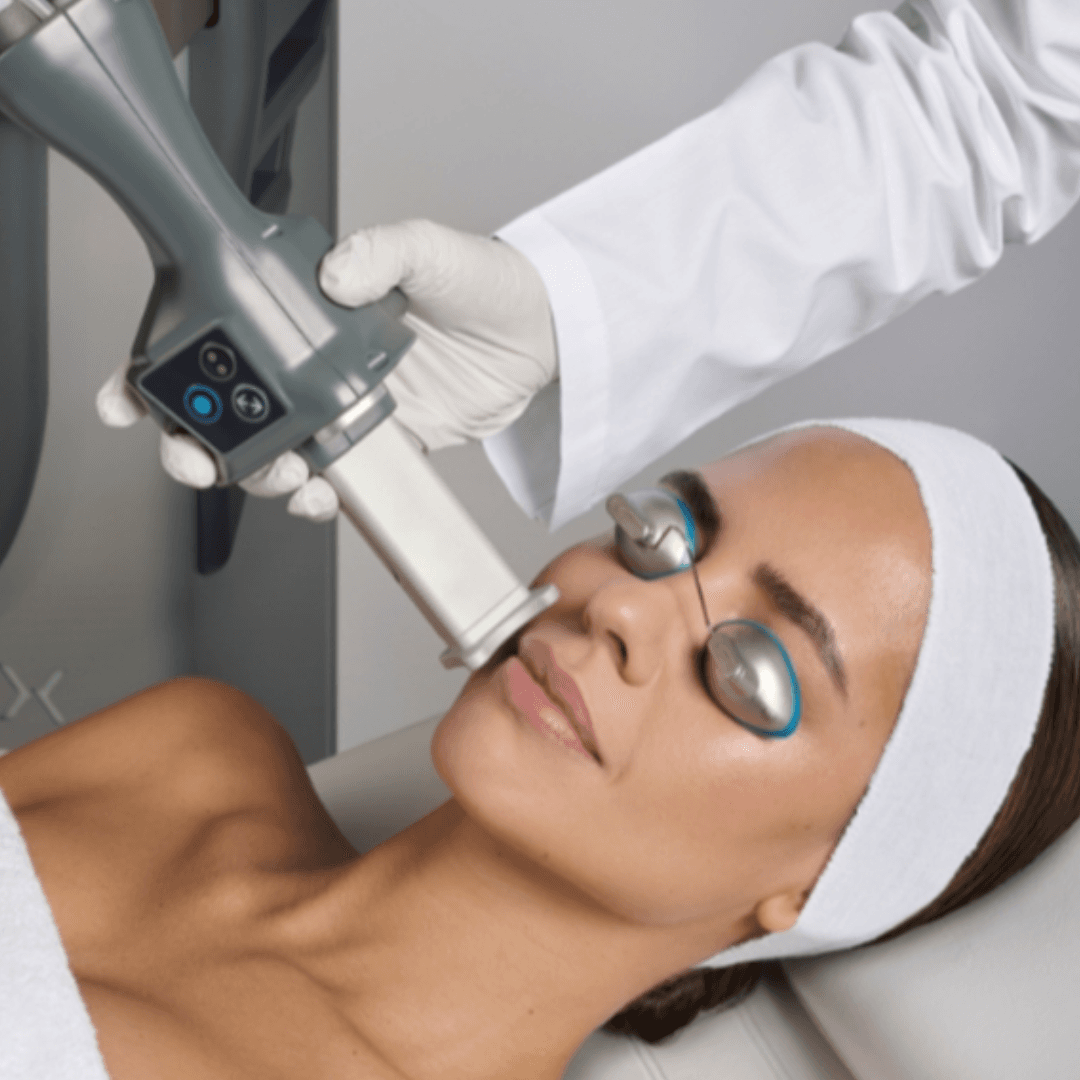 CO2 Laser – Aggressive (Face + Neck)
