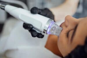 Microneedling in Sunny Isles Beach, FL - 7 Secrets to Radiant Skin